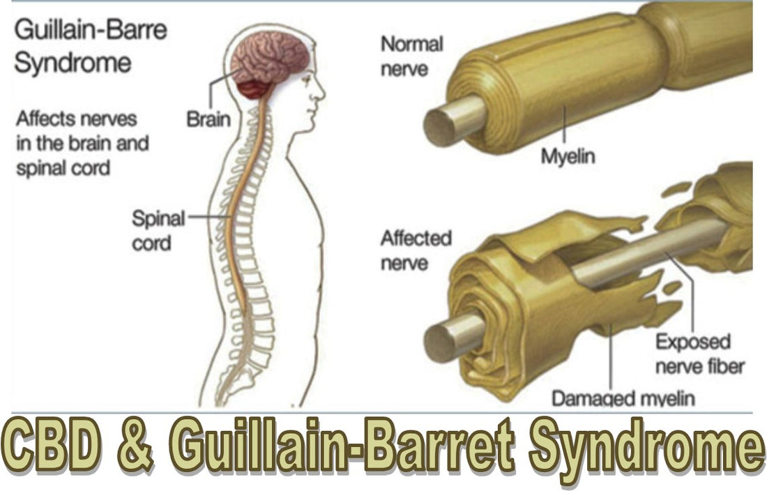 CBD & Guillain-Barre Syndrome