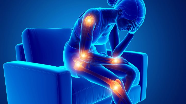 CBD vs. Arthritis